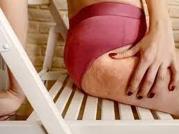 The Best Home Fix For Cellulite – Honey Massage